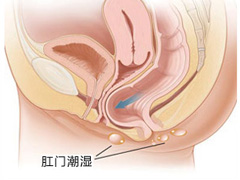 肛门潮湿.jpg